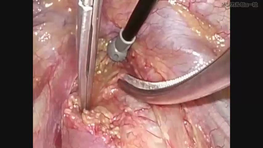 メジカルビュー社｜Movie Archives｜『新DS NOW No.1 上部消化管癌