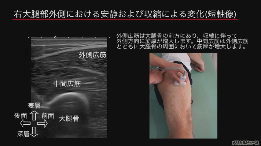 メジカルビュー社　腹部エコー　心エコー　運動器関節エコー　血管エコー　体表エコー メジカルビュー社｜Movie Archives｜『リハで活用
