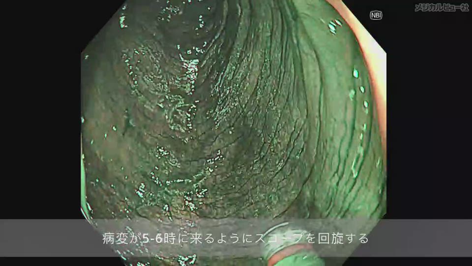 メジカルビュー社｜Movie Archives｜『レジデントのための消化器